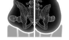 Allied Medical Ki Mobility Axiom Air LTE Cushion easy-to-use hand pump,interconnected 3" air cells,lightweight cushion