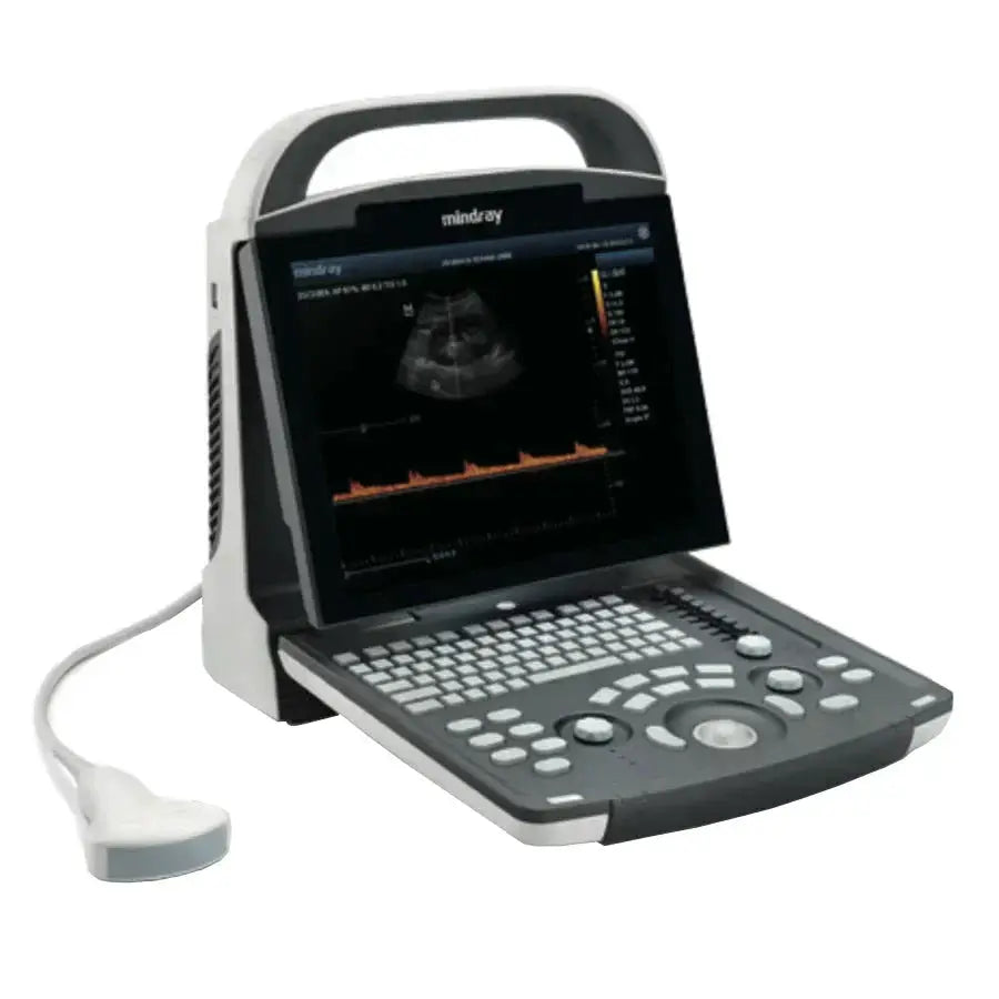 Mindray DP20 Power Diagnostic UltraSound Advanced Imaging Technologies,B/W ultrasound,compact ergonomic design,Diagnostic Imaging System,Digital Ultrasonic Diagnostic Imaging System,DP-20 Power edition,Good image quality,iClear for Speckle Reduction Imagi