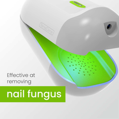 Nailit Laser Therapy for Fungal Nails – Painless Safe & Effective brighter nails,Fungal Nails,healthier nails,Improves the appearance of fungal nails,issues,Nail treatment,Nailit Laser Therapy,Pain-free and side-effect free,Painless Safe Therapy,Promotes