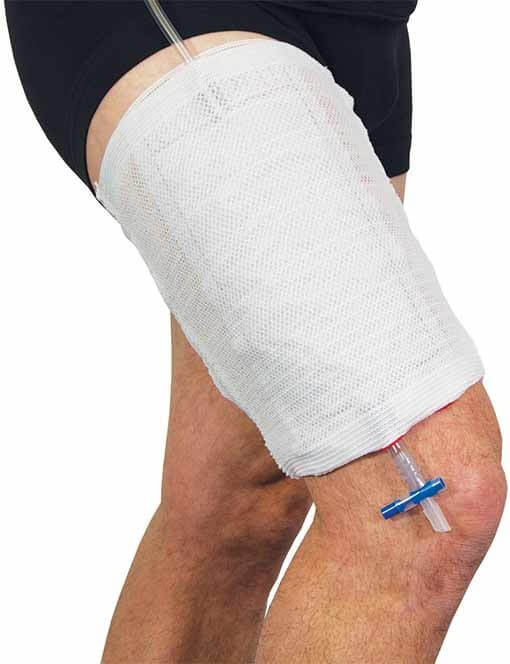 Advance® Urine Bag Leg Holder bottom drainage opening,breathable,issues,Latex free,Lightweight,Reusable,stretch support,Unisex,urinary bags,Urine Bag Leg Holder,worn either on the thigh