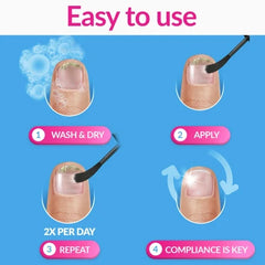 Excilor Nail Fungus Solution 30 ml
