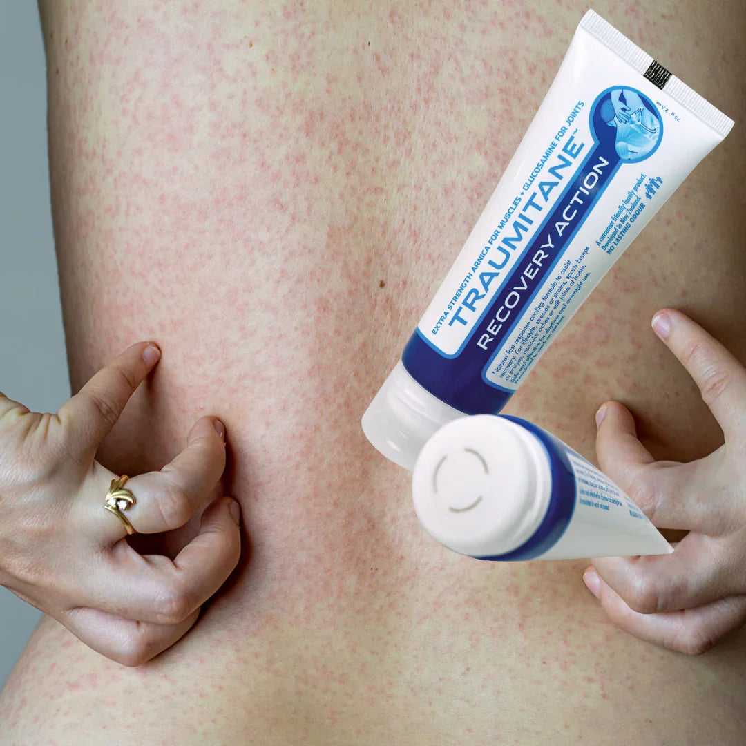 Traumitane Recovery Action arnica,arthritis,arthritis joint pain,Burdock,Capsaicin,cartilage repair.,Daily application,Deep penetration,Fast-acting,Flexibility,Glucosamine helps support joint,google,Inflammation reduction,instant pain relief,issues,Long-l